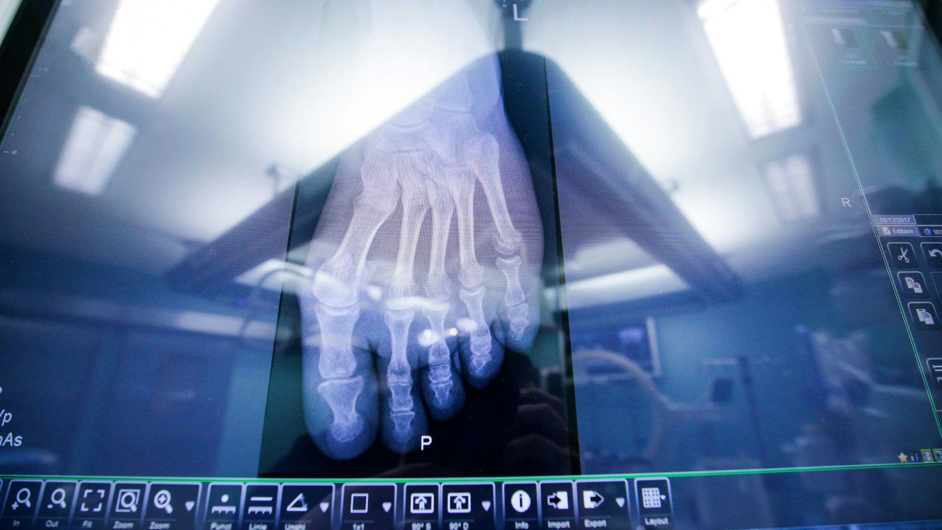 elm-pg-billboard-form CC-RadTech_1920x1080